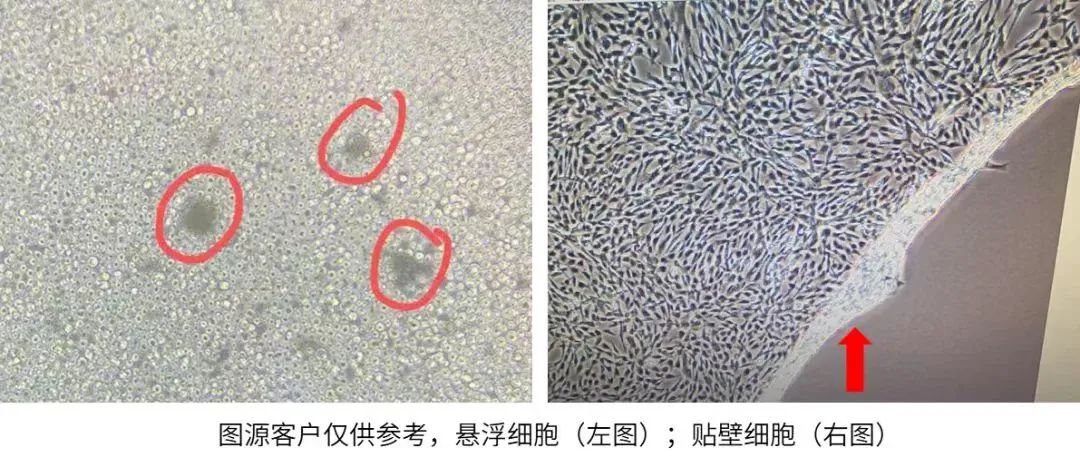 悬浮细胞和贴壁细胞