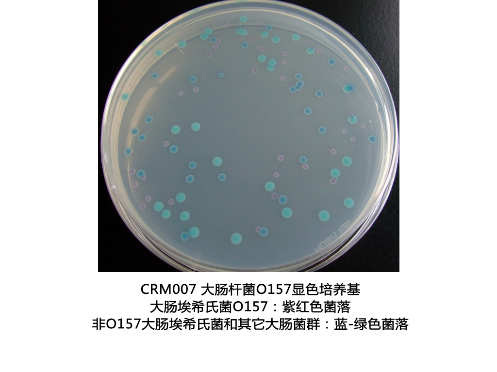 大肠杆菌O157:H7显色培养基生物图册 大肠杆菌O157:H7显色培养基生物图册
