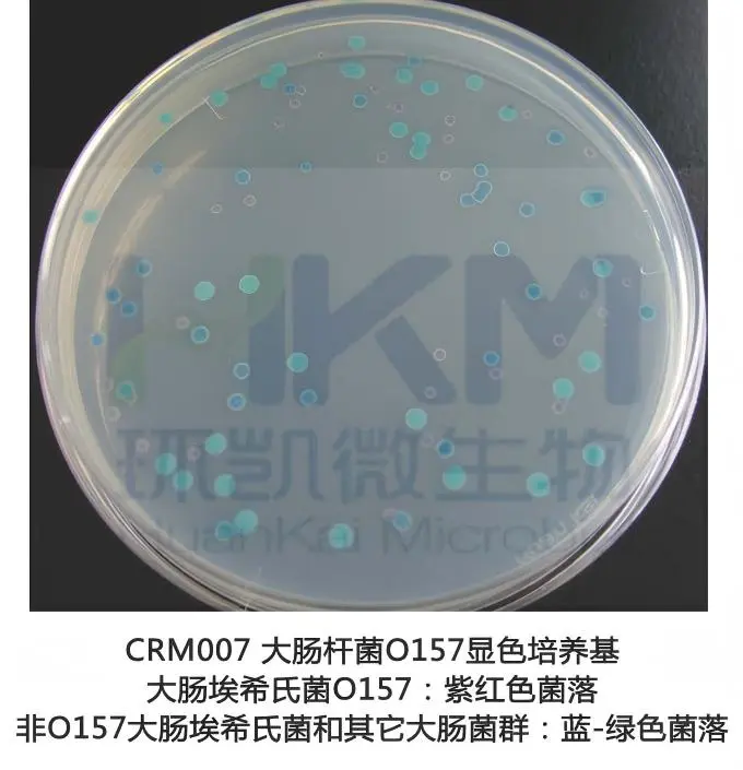 大肠杆菌O157显色培养基菌落特征 大肠杆菌O157显色培养基菌落特征
