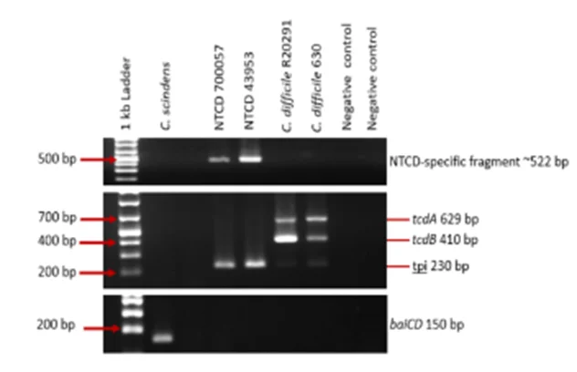 NTCD特异性PCR在参考菌株中的特异性验证结果