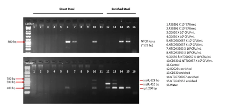 粪便样本富集与否对NTCD PCR检测效果的影响