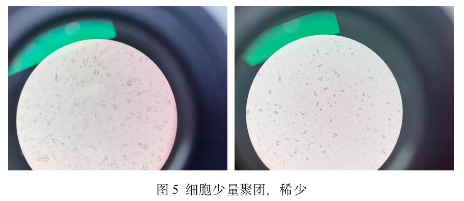 细胞少量聚团,稀少 细胞少量聚团,稀少