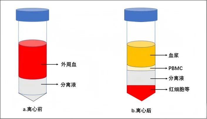 PBMC密度梯度离心法示意图